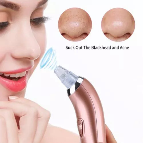 Electric Blackhead Acne Oil Remover