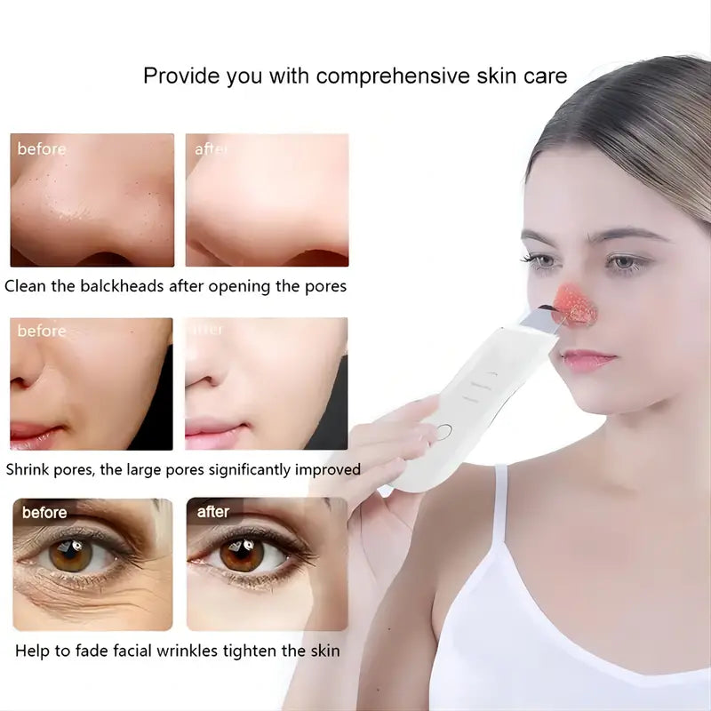 Blackhead Shovel Machine For Facial Skin Scrubber