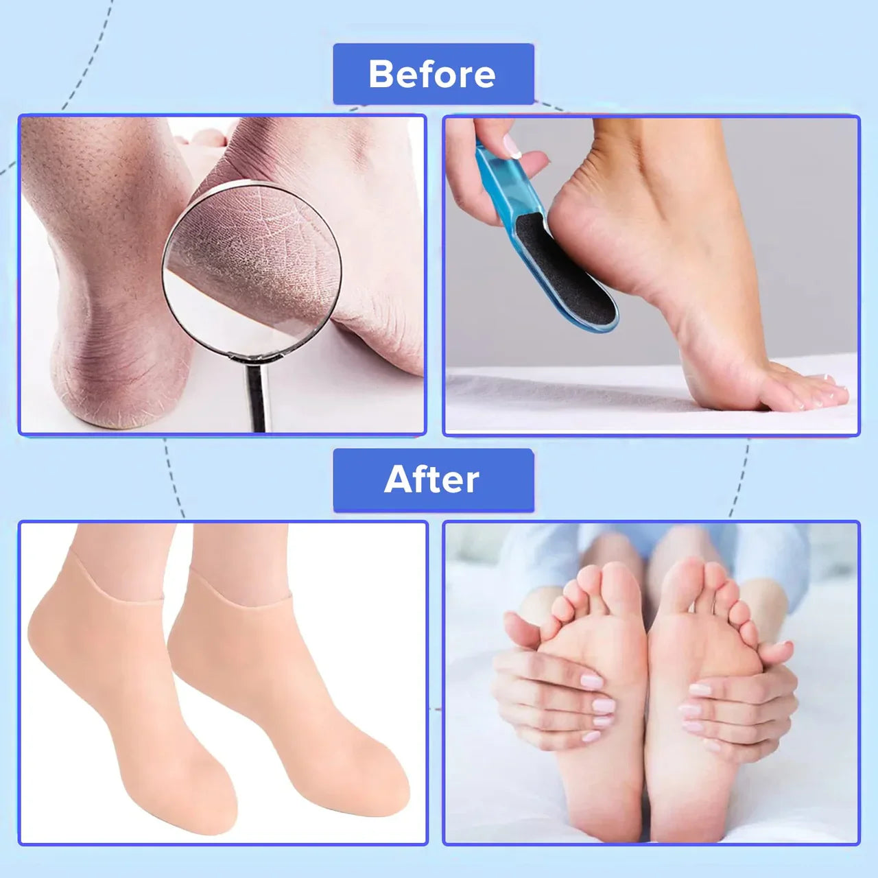 Moisturizing Silicone Socks
