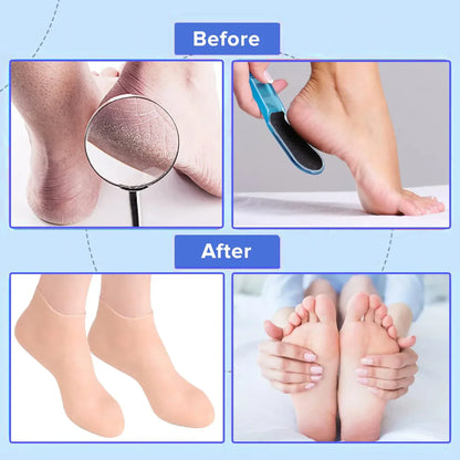 Moisturizing Silicone Socks