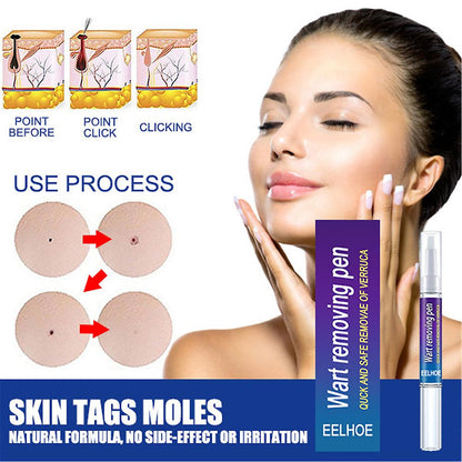 Warts Remover Original Cream Wart Removal