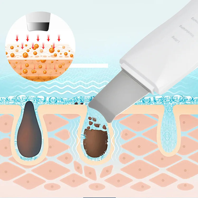 Blackhead Shovel Machine For Facial Skin Scrubber
