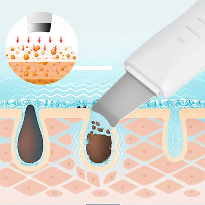 Blackhead Shovel Machine For Facial Skin Scrubber
