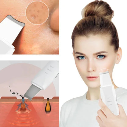 Blackhead Shovel Machine For Facial Skin Scrubber